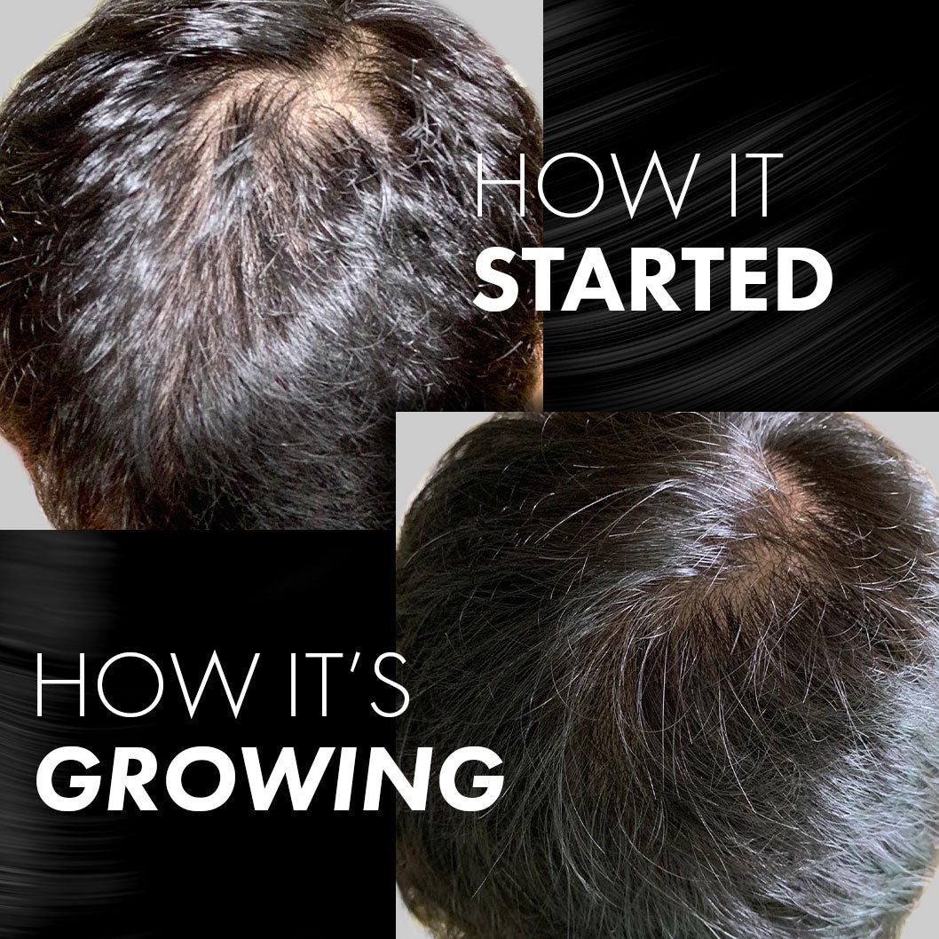 MIRIQA® Professional Hair Nutrition Supplement 60's