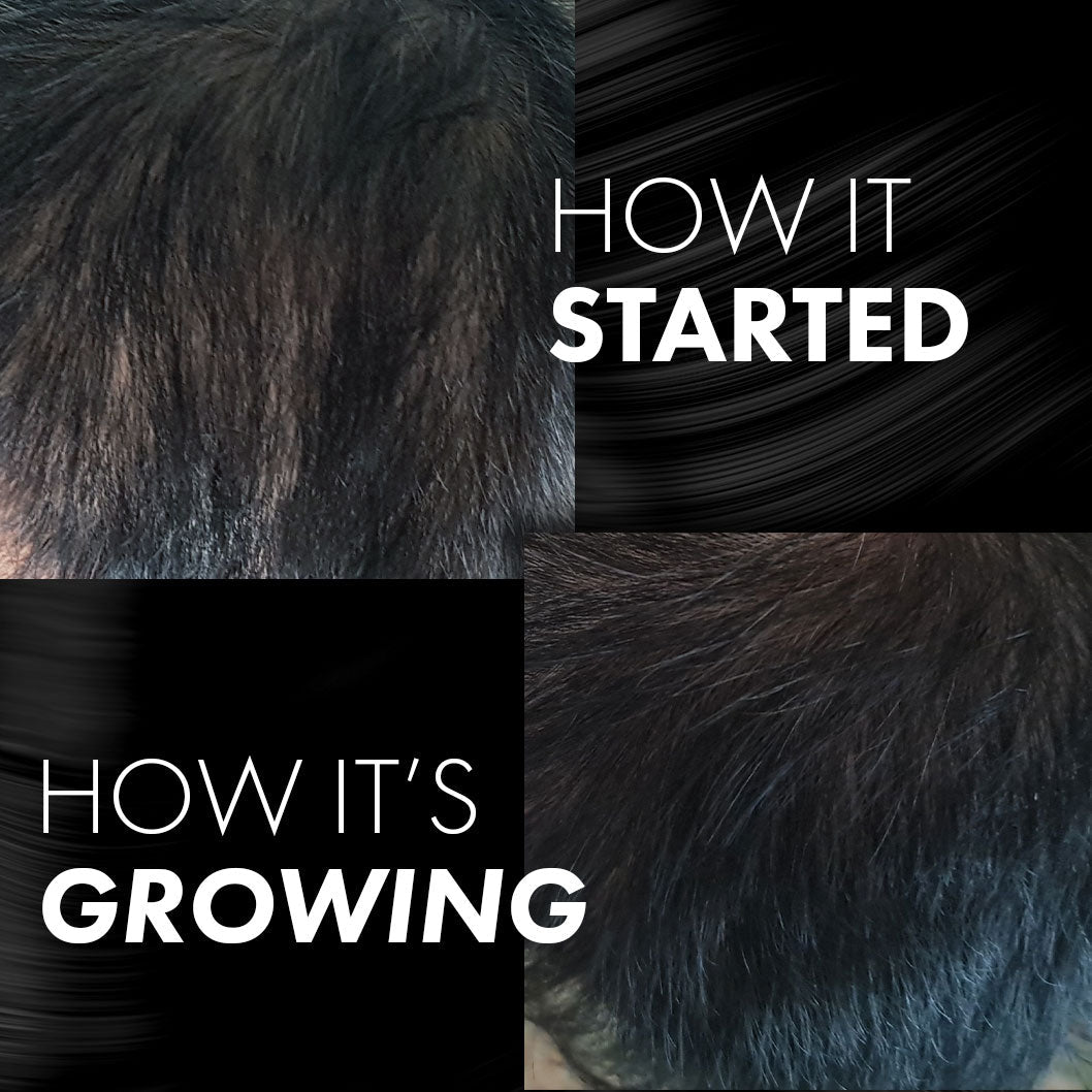 MIRIQA® Professional Hair Nutrition Supplement 60's