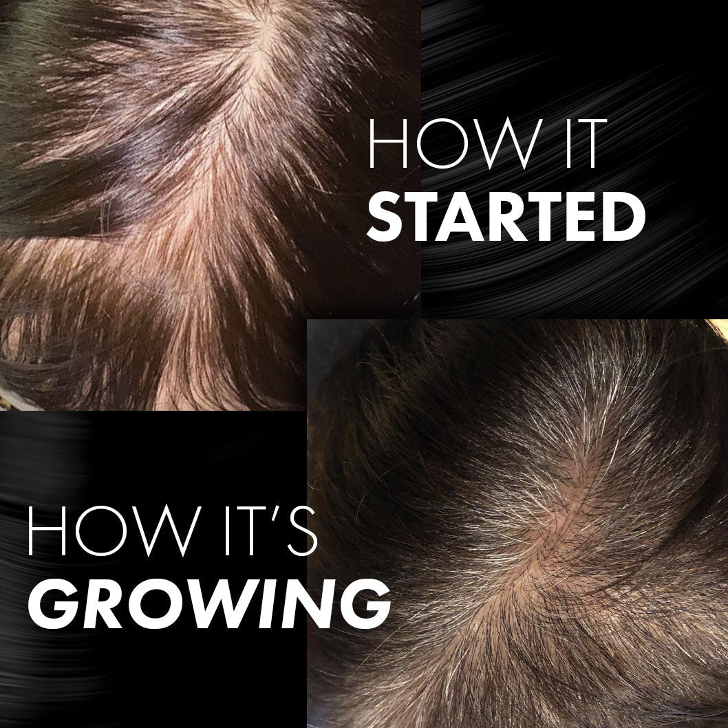 MIRIQA® Professional Hair Nutrition Supplement 60's