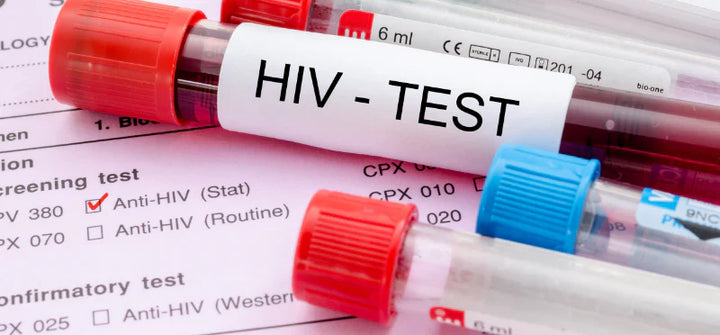 “I don’t know my HIV status. Should I test for it?” A Step-by-Step Guide to HIV Testing and Immediate Action.